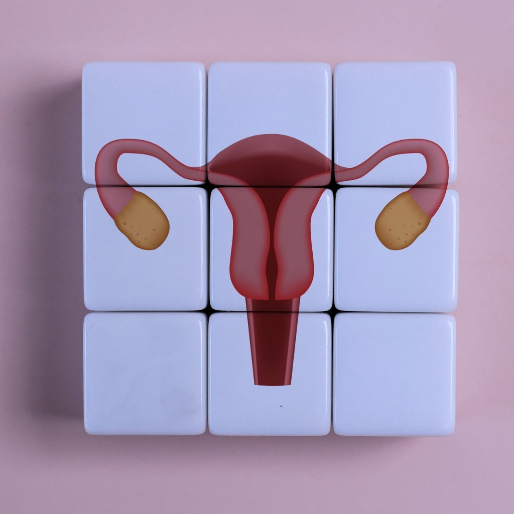 PCOS and Cholesterol 